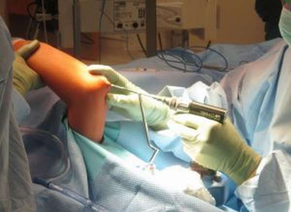 Хирургическая коррекция - как основной методом ликвидации негативных последствий лечения